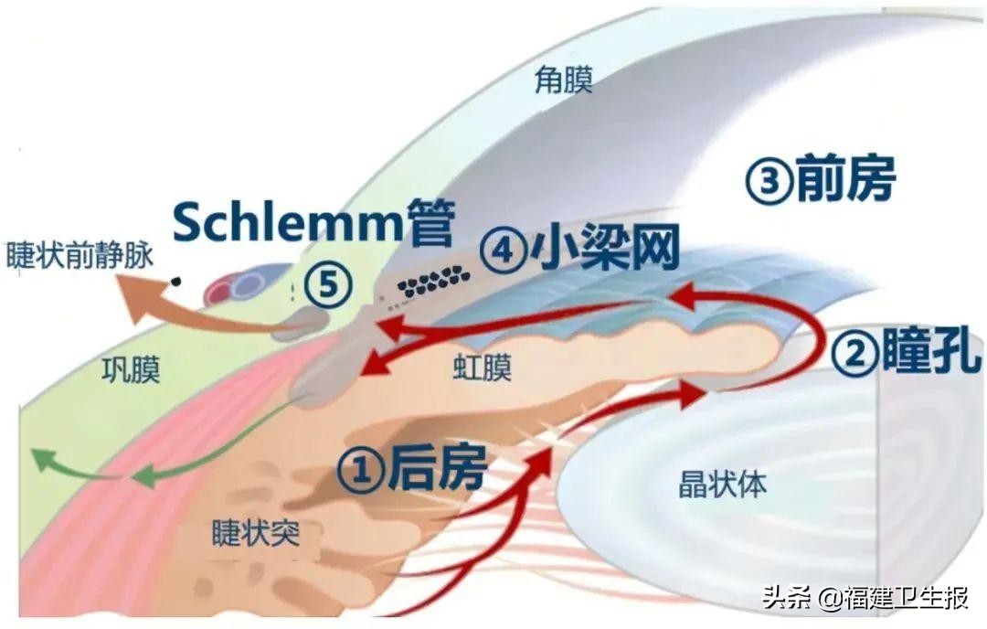 砂轮片击中眼球,砂轮片爆开击中头部事故