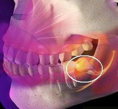 牙痛值得收藏的处方药,牙痛十个妙方建议收藏