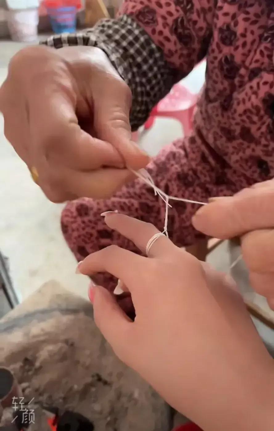 江西一女子长鸡眼想去医院看眼,奶奶竟用土法绑7个结,有用吗?