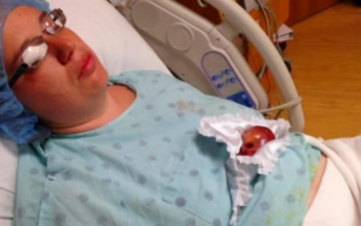 拇指姑娘出生时只有10公分,拇指姑娘出生时仅280克长大