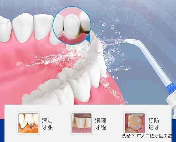 洗牙200多300贵吗,为什么洗牙价格相差很多