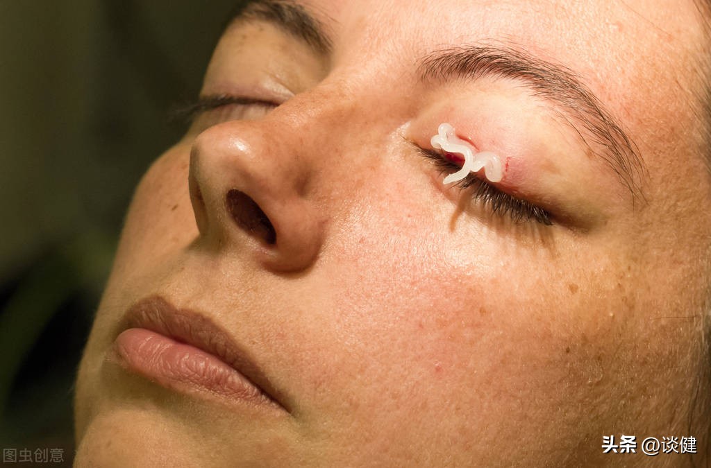 五种致盲性眼病应该要警惕,每天用眼过度需要滴什么眼药水吗