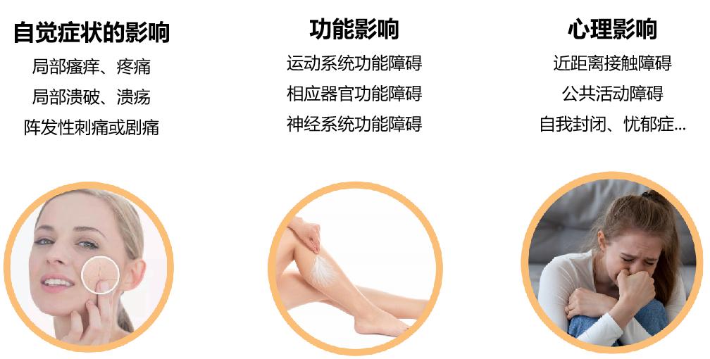 疤痕发黑发硬变厚怎么解决,疤痕凸起变硬如何处理