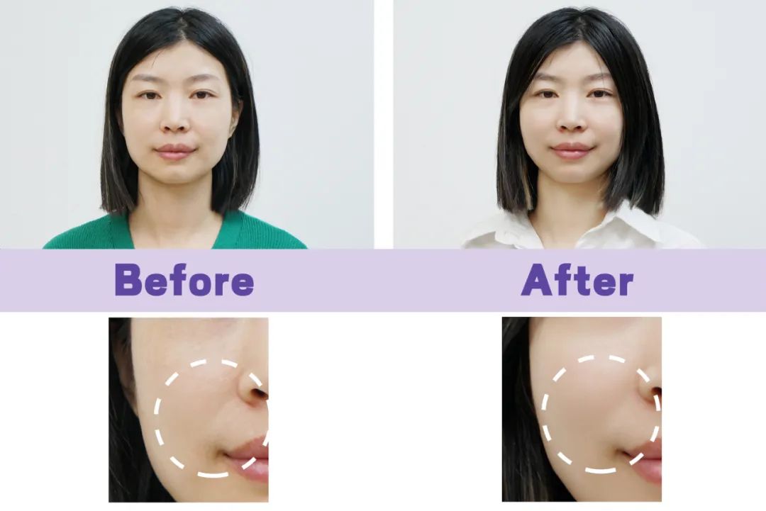 美肌抗老,城野医生169抗老精华测评