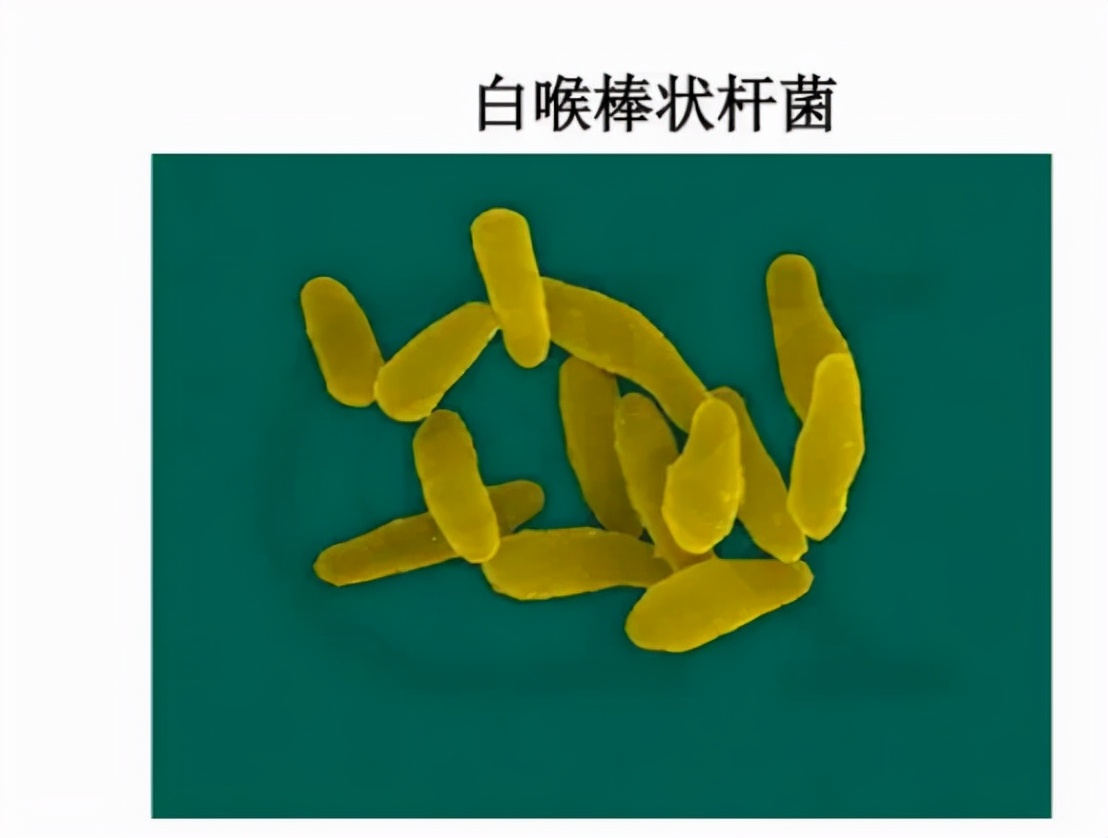 使用头孢时的注意事项需牢记,服用头孢的注意事项有哪些