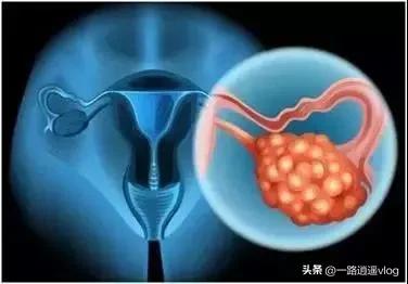 美女去日本美国奋斗20年，花200万买美国200平豪宅，得癌症想回国