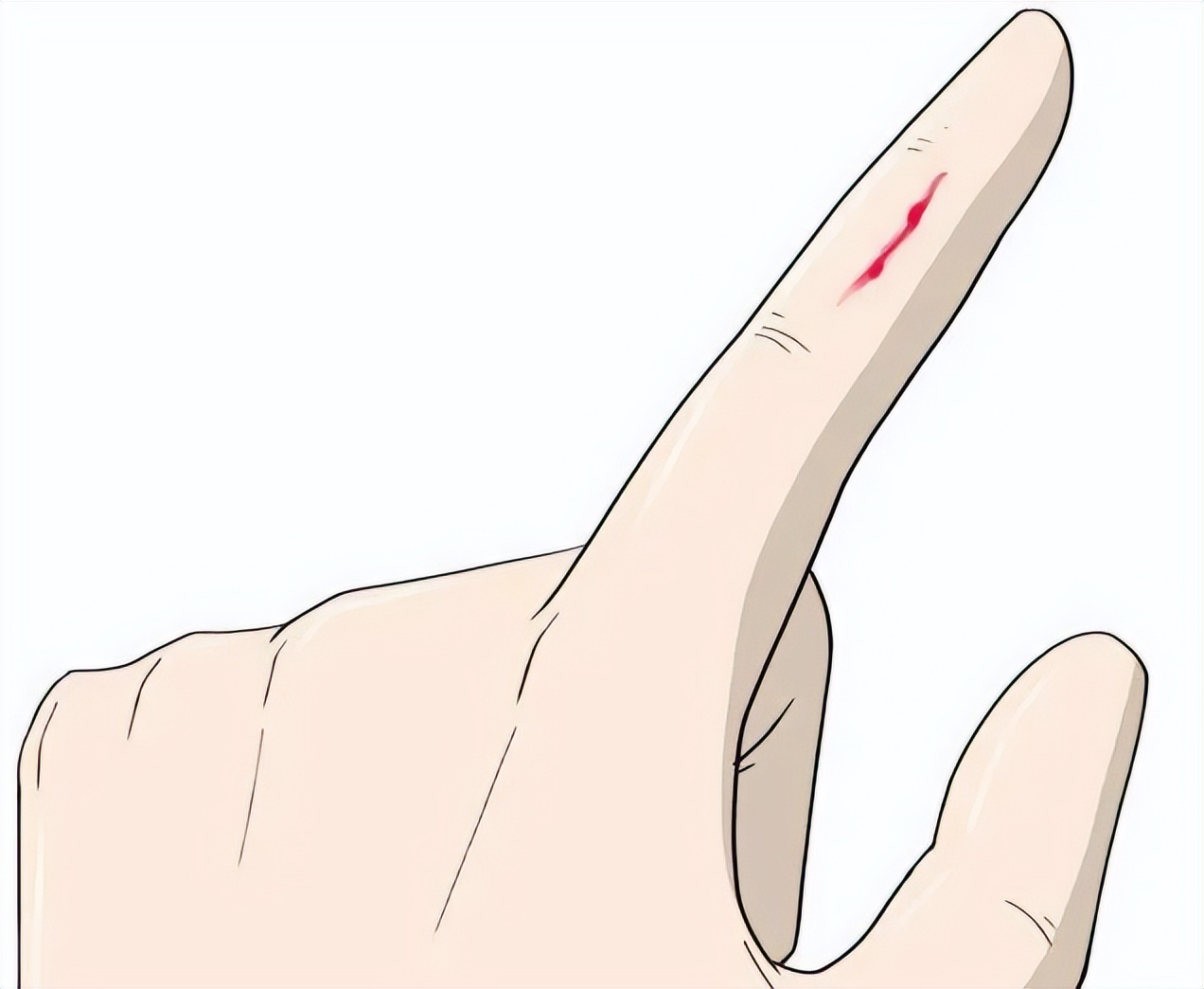 腿磕破了伤口深需要打破伤风吗,嘴巴里磕破需要打破伤风吗