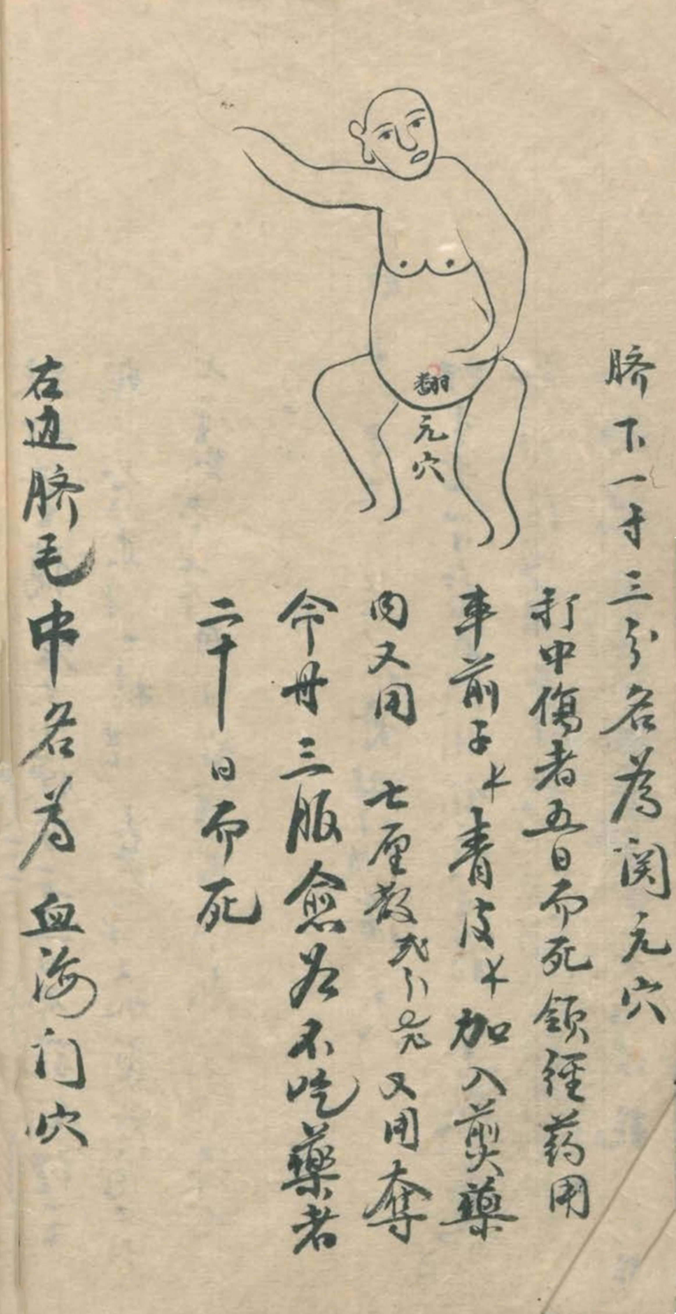 最实用的跌打药方,祖传跌打秘方100首