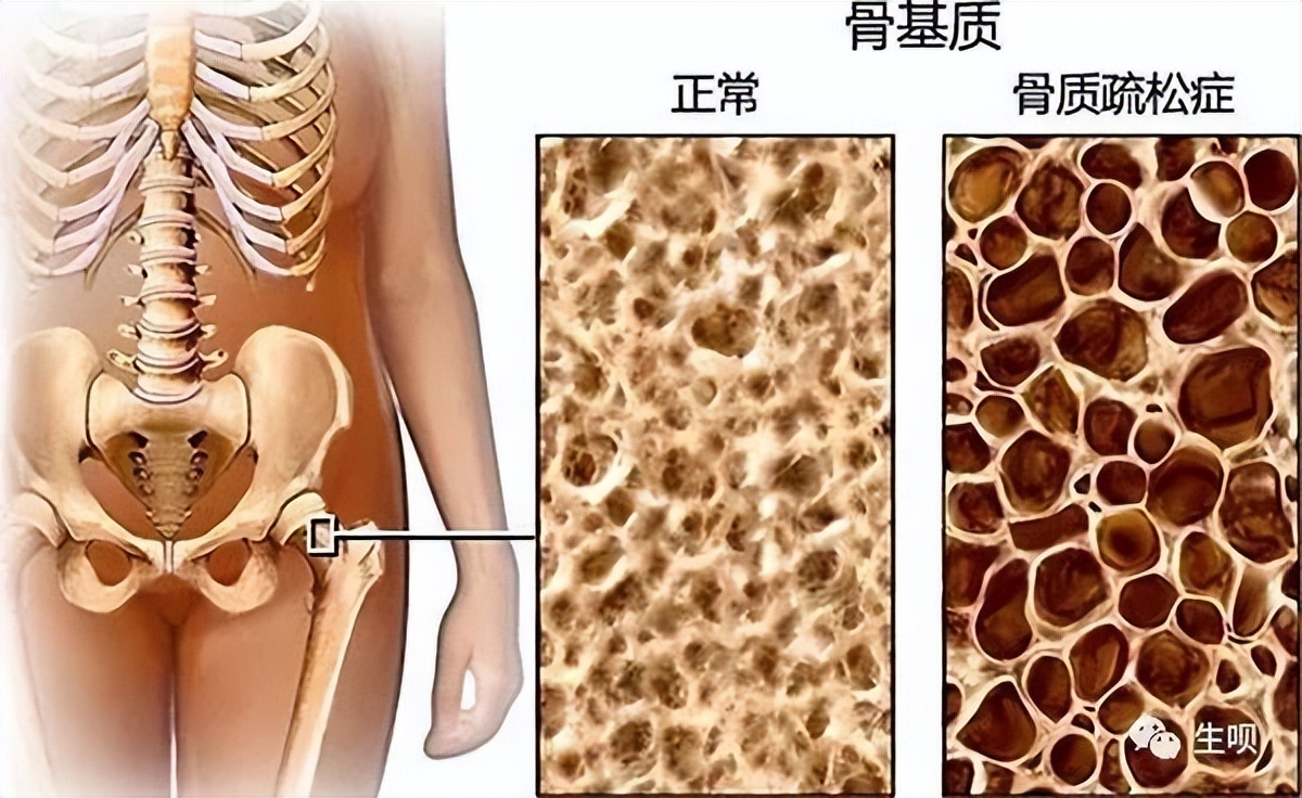 大豆异黄酮是处方药吗,大豆异黄酮是药还是补品