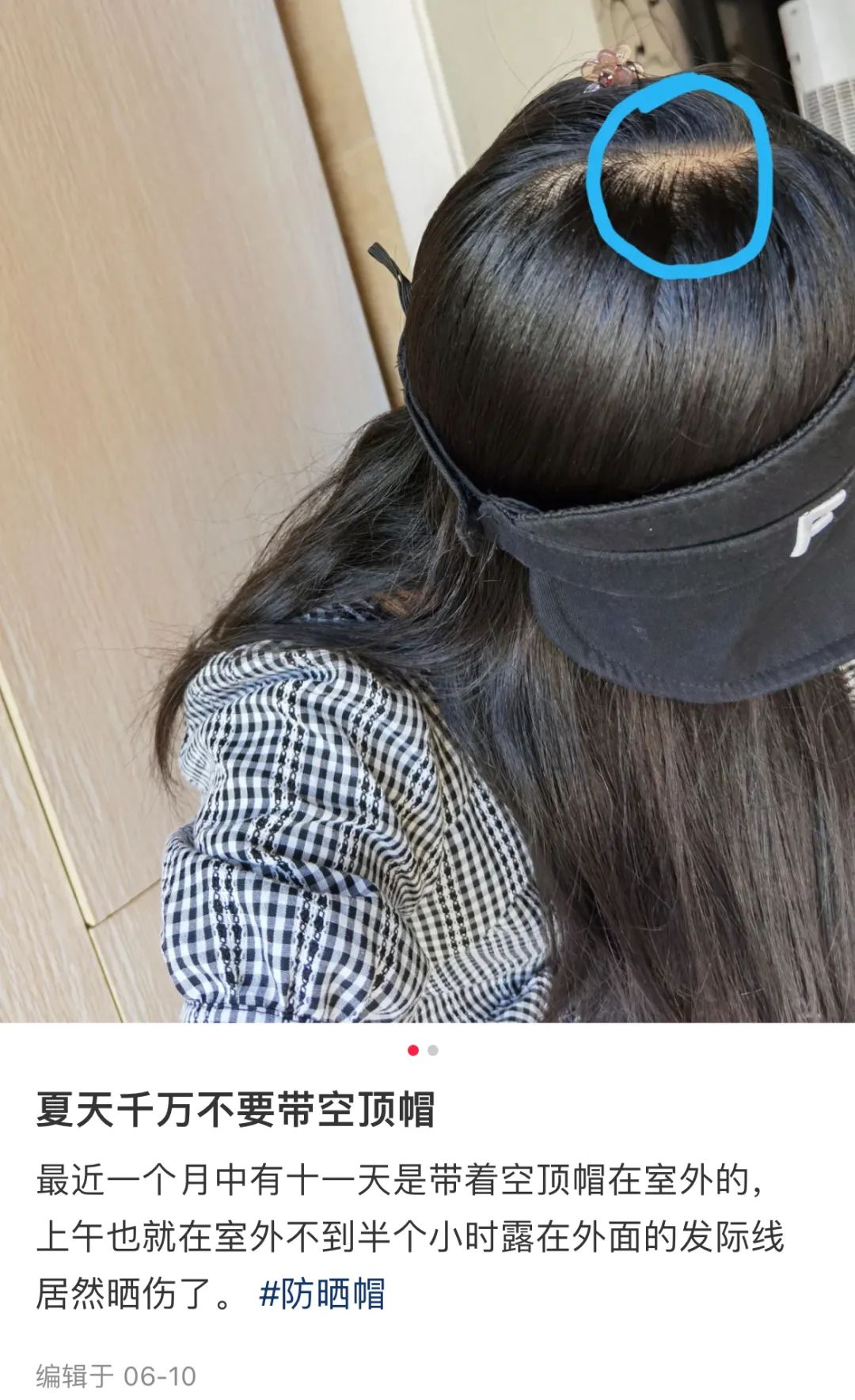 防晒帽越戴越黑是怎么回事,戴防晒帽显眼圈黑