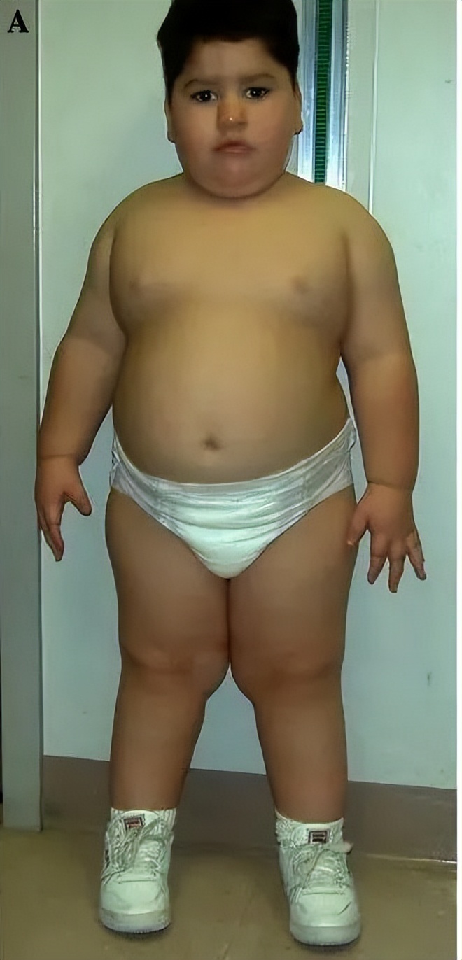 试管婴儿pgt-a检测结果怎么看,试管婴儿不孕不育基因检测