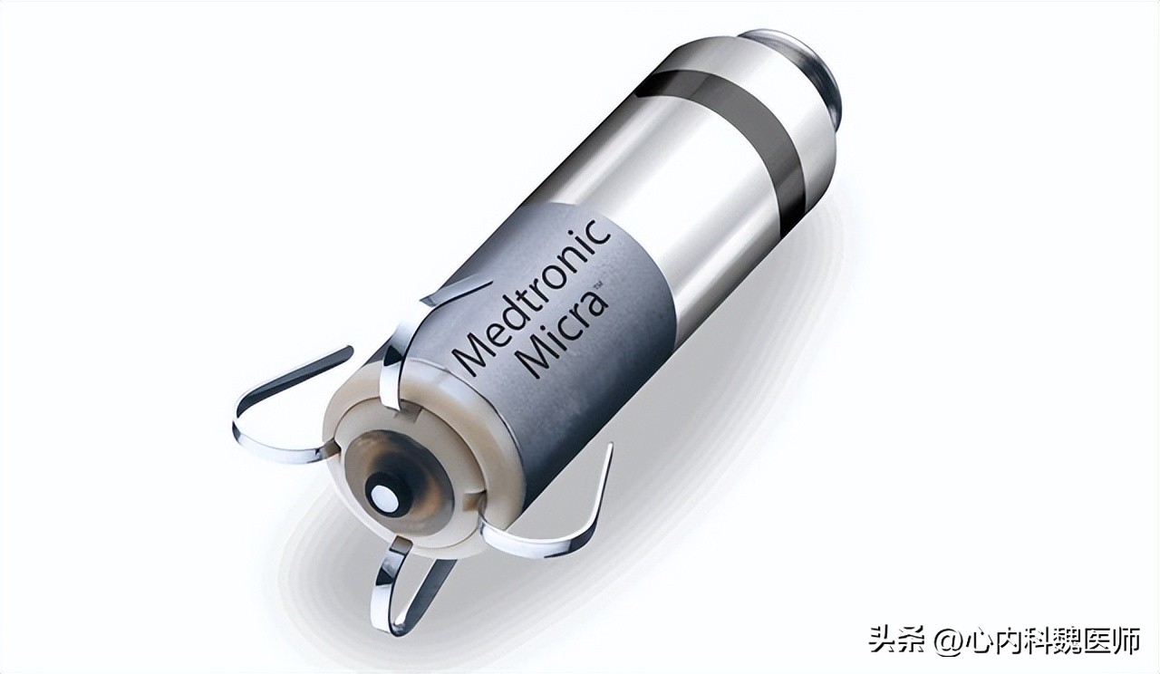 体检窦性心律正常心电图啥意思,体检报告显示窦性心律是什么意思