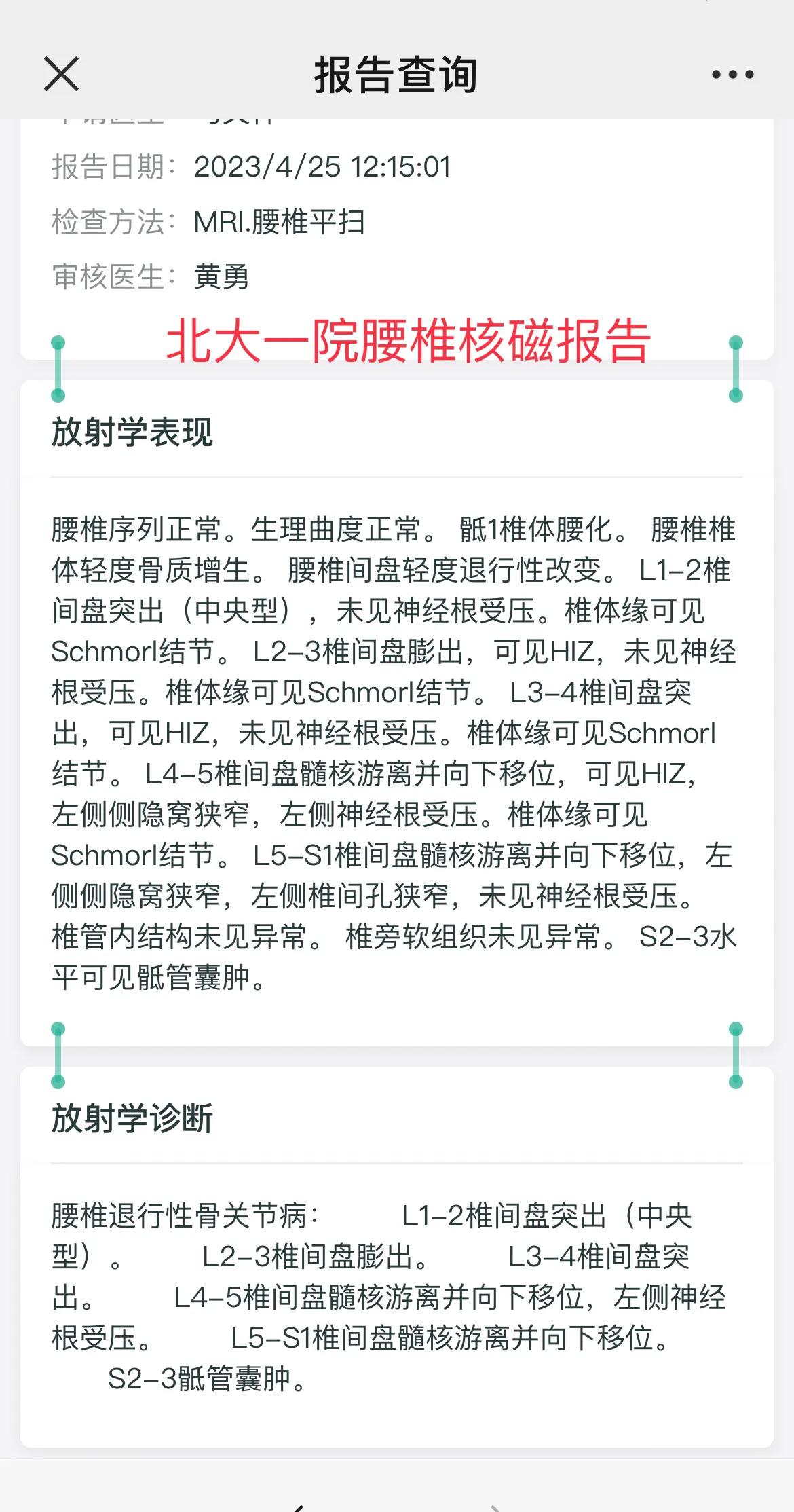 腰椎滑脱手术记录,腰椎间盘突出手术26天恢复记录