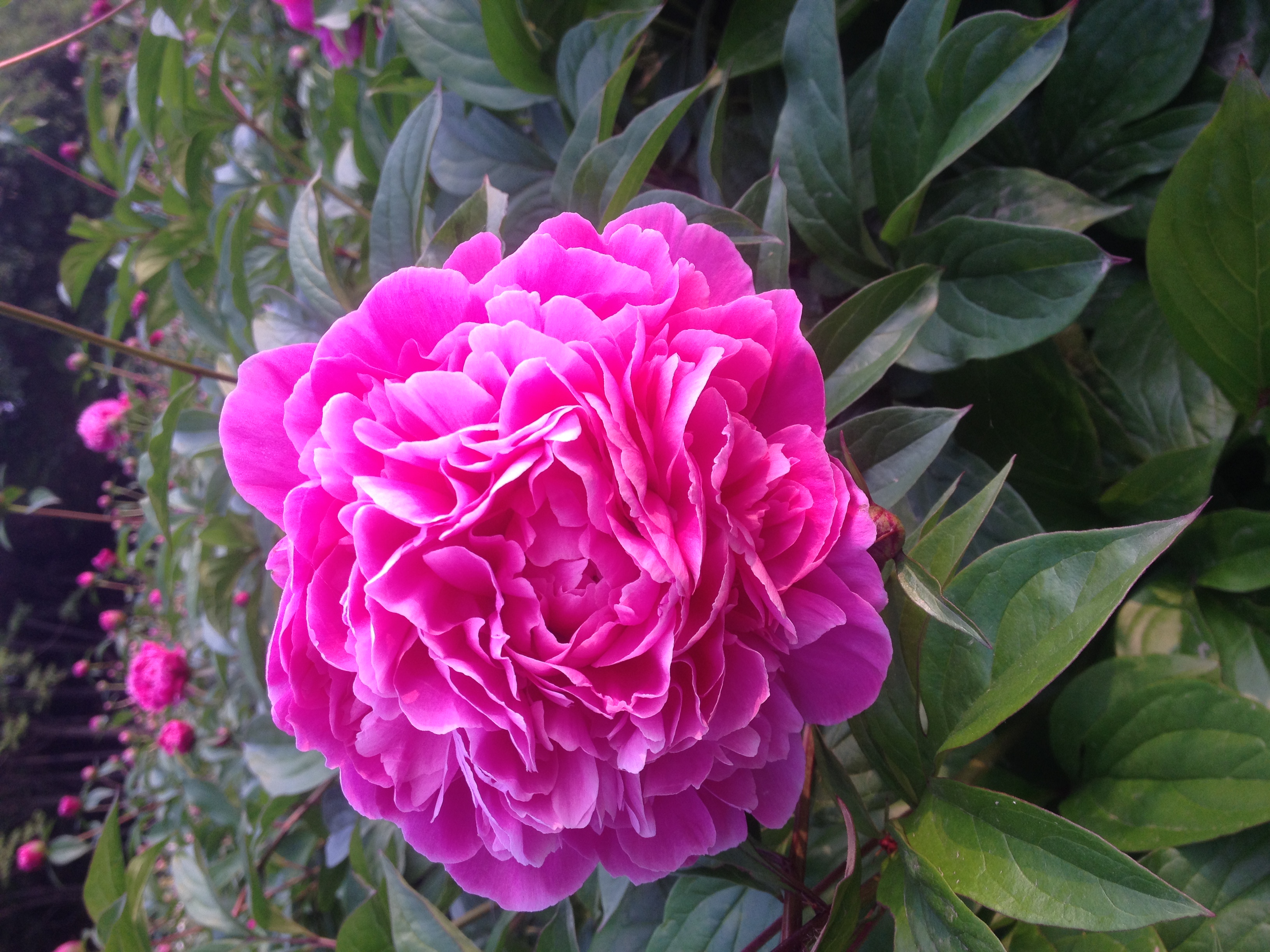 宫颈癌能治愈吗怎么治疗,宫颈癌能治愈吗可以活多久