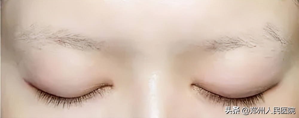 种植眉毛有哪些方法图,怎么种植眉毛效果最好
