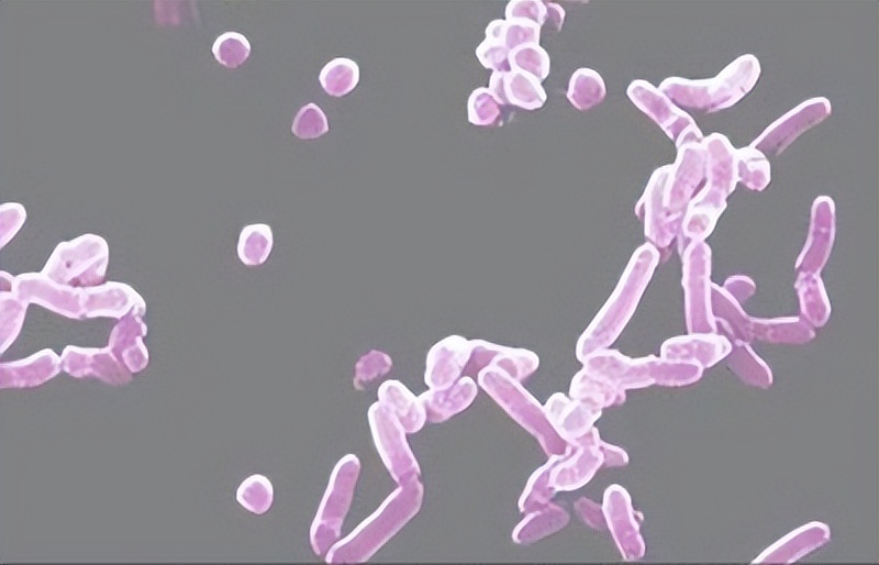 唾液酸与杜克雷嗜血杆菌周质结合蛋白之间相互作用的分子特征