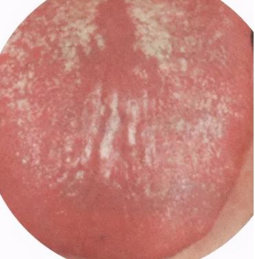 失眠4种中成药解决你的睡眠难题,失眠彻底治愈的七大方法