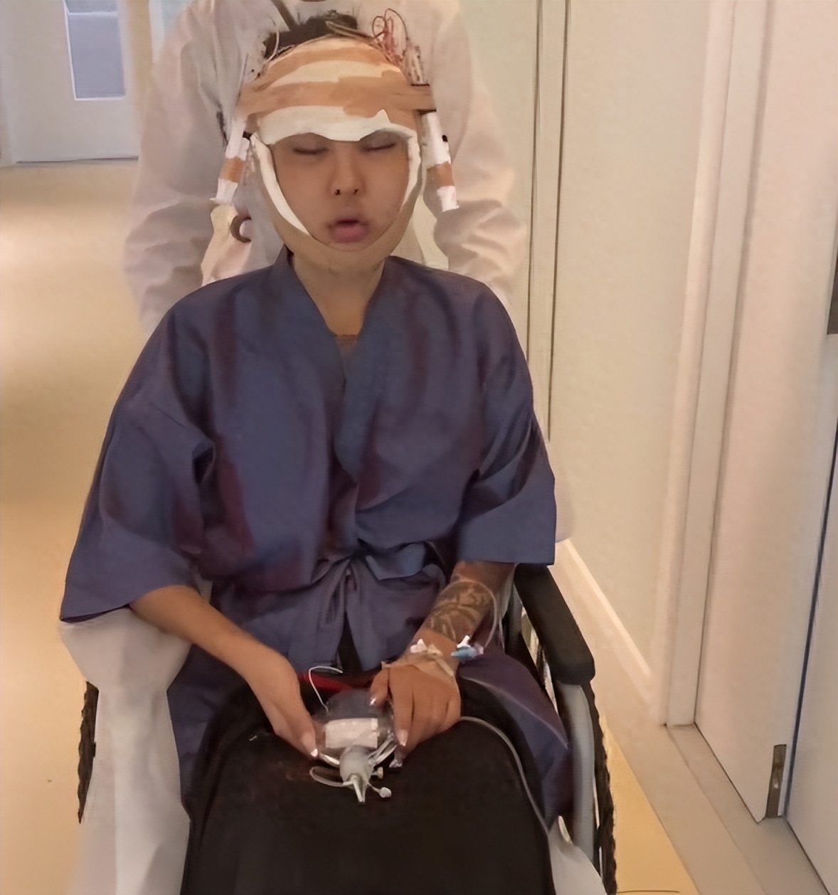 网红整容毁容真实案例,各大网红整容之后的后果