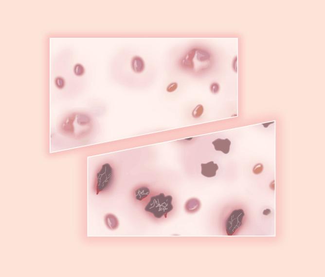 大腿里侧发黑发痒怎么办,大腿两侧发痒变黑用什么药