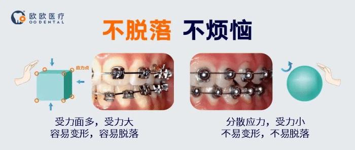 球托牙套,牙套很容易掉怎么办