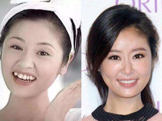 连屁股都是假的？假肩、假发、假腹肌，这些明星身上还有啥是真的