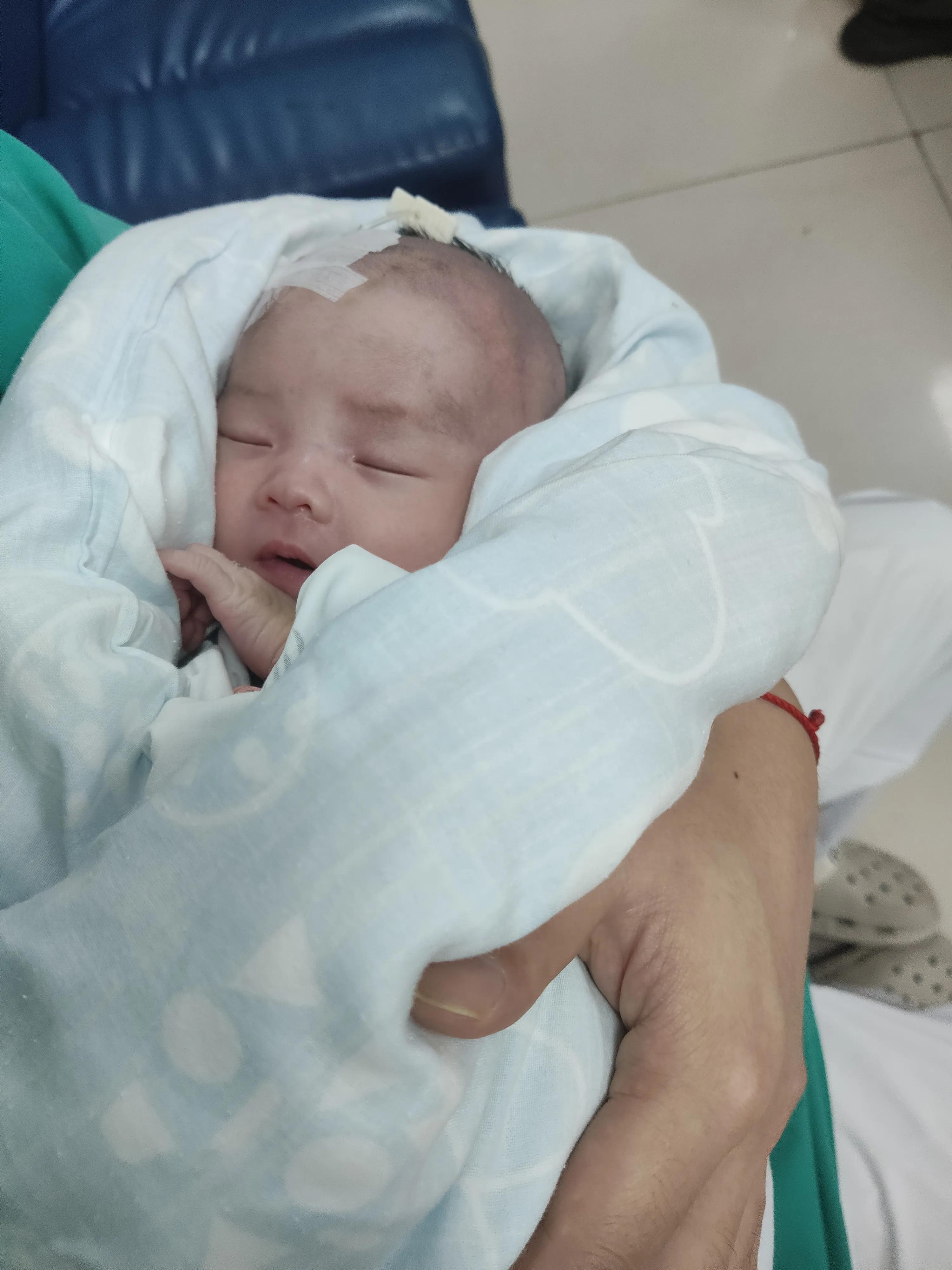 婴儿牛奶蛋白过敏最快解决办法,婴儿蛋白过敏怎么转奶