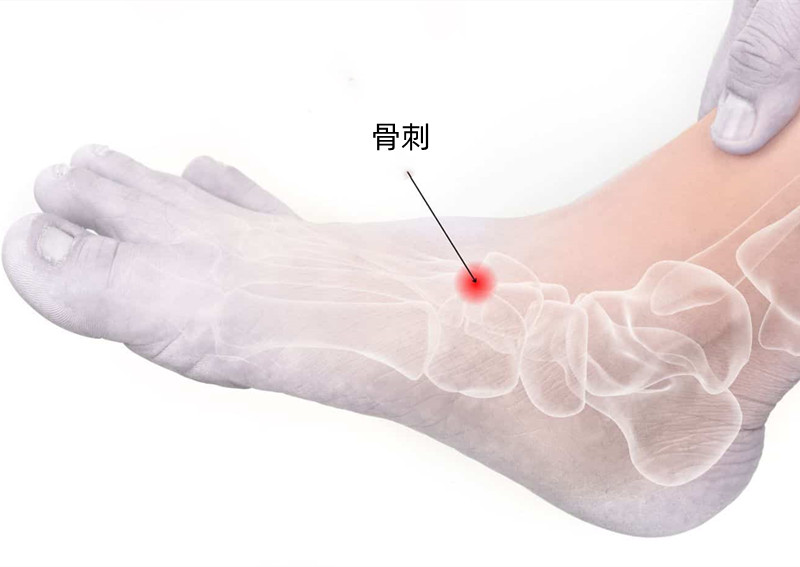 小孩脚背疼痛警惕四种病,走路脚背疼痛警惕四种病