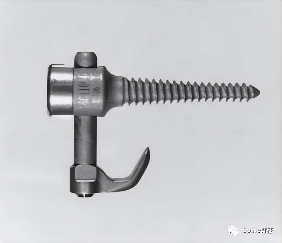 轻度峡部裂和重度峡部裂的区别,真性峡部裂和假性峡部裂