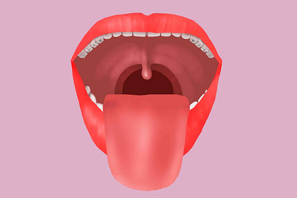 怎么去除扁桃体结石性口臭,口臭就一定与口腔疾病有关