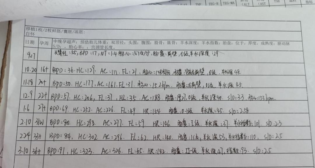 看到宝宝感动的瞬间,看到宝宝的那一刻所有的痛都值了