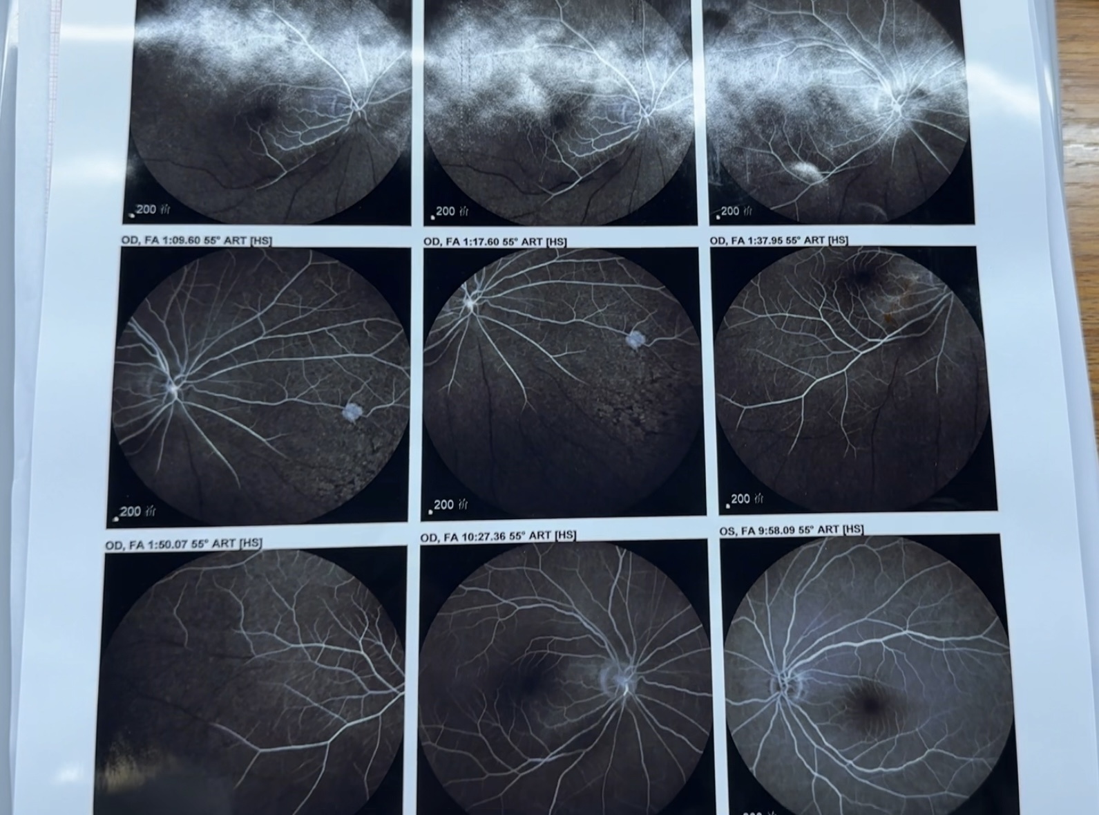 鐪肩潧涔熶細鍫靛悧,鐪肩潧姊楅樆