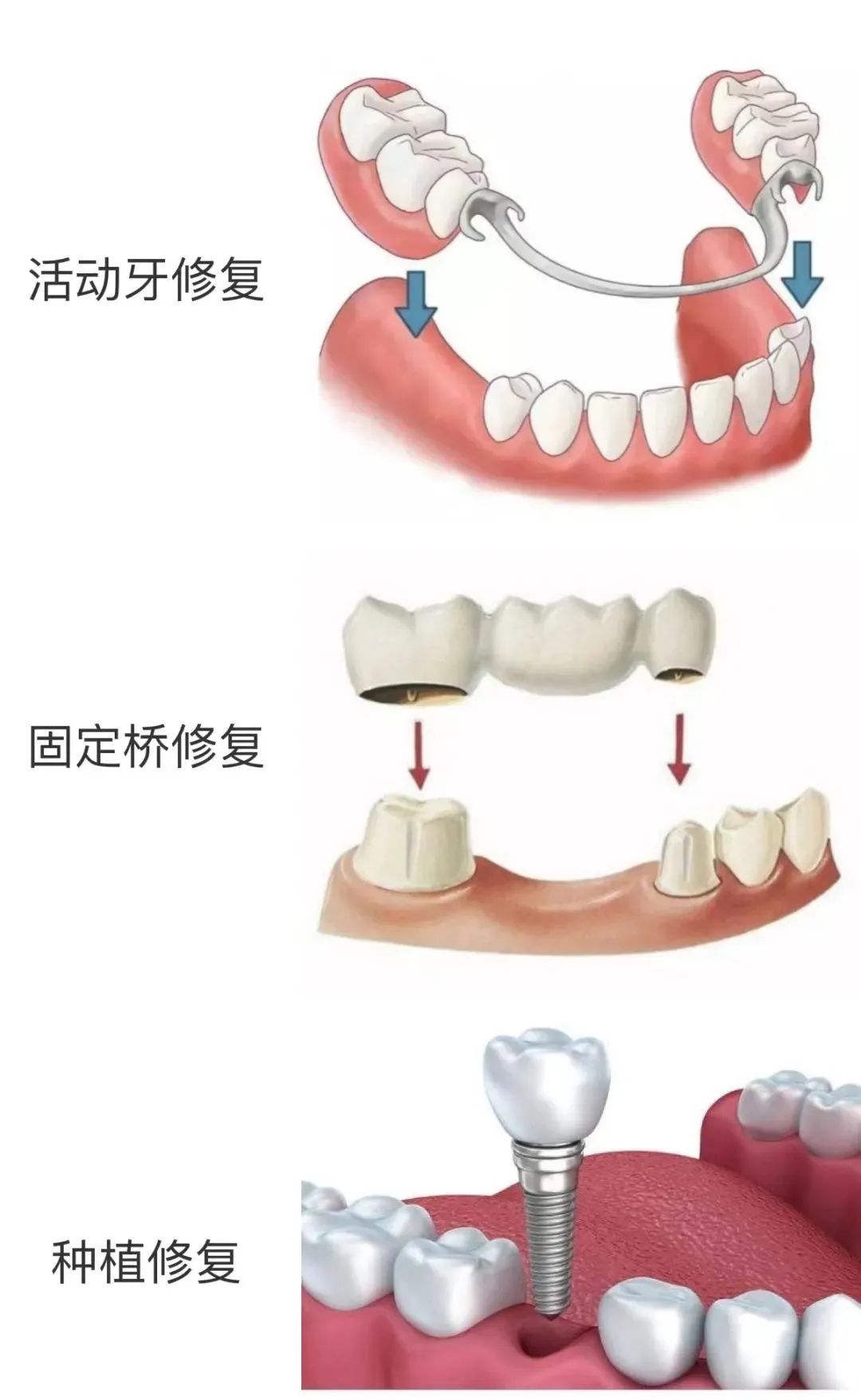 口腔溃疡跟牙龈炎挂口腔哪个科室,扁桃体和牙龈挂号看哪科