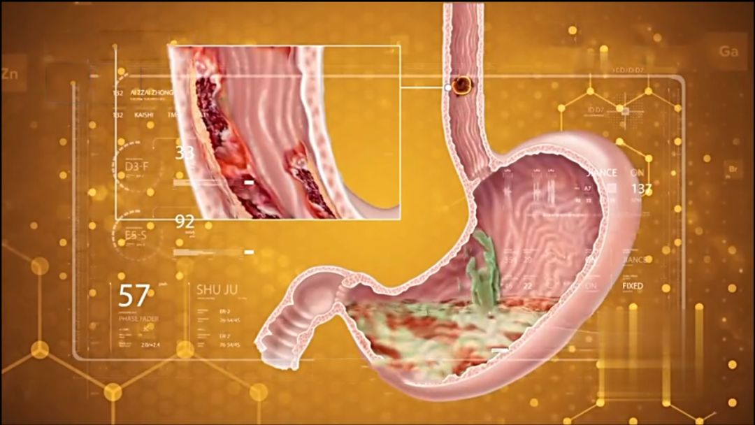 早上睡醒口苦有口臭怎么回事,早上睡醒口苦有痰怎么回事