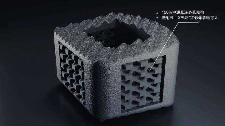 追梦人⑧乌镇创业“学霸夫妻”：用“微孔3D打印”构建能生长的人工骨骼