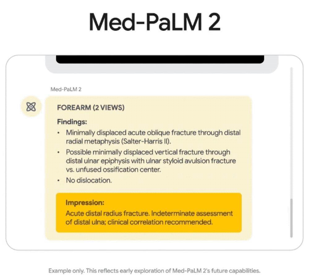 谷歌最新折叠屏手机售价,谷歌ai人工智能手机
