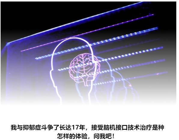 脑中植入芯片后，17年的抑郁症好了，那真情实感呢