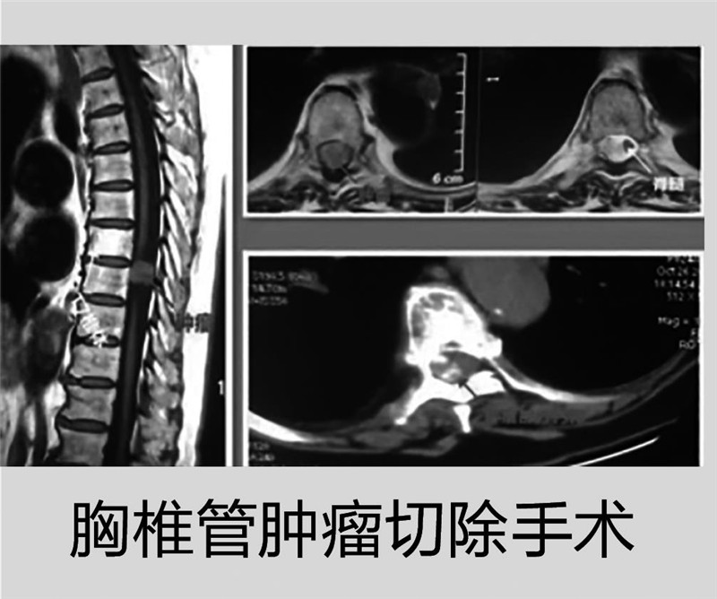 西安市第五医院外科：用精湛医术为患者健康保驾护航
