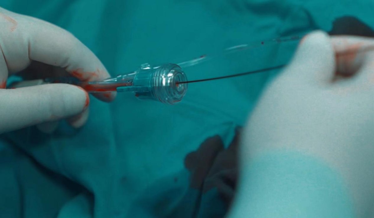 出血性疾病的早期症状是什么呢,出血性疾病的鉴别诊断总结